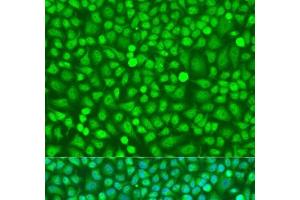 Immunofluorescence analysis of U2OS cells using HOXB5 Polyclonal Antibody at dilution of 1:100. (HOXB5 Antikörper)