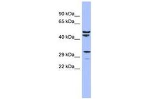 Image no. 1 for anti-Mitochondrial Ribosomal Protein S15 (MRPS15) (AA 35-84) antibody (ABIN6742891)