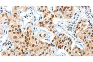 Immunohistochemistry (Paraffin-embedded Sections) (IHC (p)) image for anti-Adaptor Protein, phosphotyrosine Interaction, PH Domain and Leucine Zipper Containing 1 (APPL1) antibody (ABIN7234818)