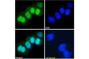 Immunofluorescence staining of fixed A431 with anti-p53 antibody PAb421. (Rekombinanter p53 Antikörper  (AA 371-380))