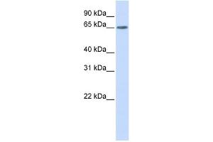YTHDF3 antibody used at 1 ug/ml to detect target protein.