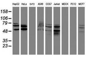 Image no. 2 for anti-SUMO1/sentrin/SMT3 Specific Peptidase 2 (SENP2) (AA 139-523) antibody (ABIN1490926) (SENP2 Antikörper  (AA 139-523))