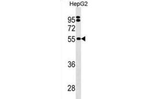 Western Blotting (WB) image for anti-Sep (O-phosphoserine) tRNA:Sec (Selenocysteine) tRNA Synthase (SEPSECS) antibody (ABIN3000193) (SEPSECS Antikörper)