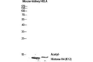 Western blot analysis of Mouse-kidney HELA lysis using Acetyl-Histone H4 (K12) antibody.