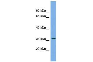 WB Suggested Anti-CDCA5 Antibody Titration: 0.