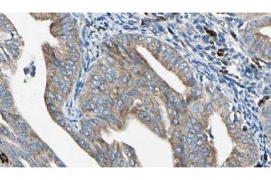 Immunohistochemistry (IHC) image for anti-RAB11B, Member RAS Oncogene Family (RAB11B) (C-Term) antibody (ABIN6264548)