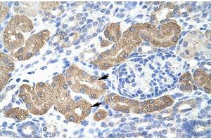 Rabbit Anti-L3MBTL2 Antibody Catalog Number: ARP30080 Paraffin Embedded Tissue: Human Kidney Cellular Data: Epithelial cells of renal tubule Antibody Concentration: 4. (L3MBTL2 Antikörper  (C-Term))