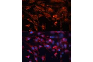 Immunofluorescence analysis of C6 cells using Cation-independent M6PR (Cation-independent M6PR (IGF2R)) antibody (ABIN6130063, ABIN6142247, ABIN6142248 and ABIN6216853) at dilution of 1:100. (IGF2R Antikörper  (AA 2327-2491))