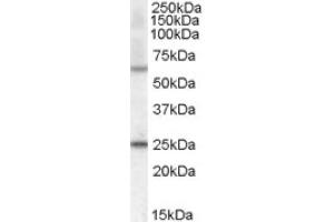 Image no. 1 for anti-Collagen, Type IV, alpha 3 (Goodpasture Antigen) Binding Protein (COL4A3BP) (Internal Region) antibody (ABIN374934)