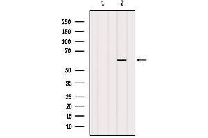 Western Blotting (WB) image for anti-Regulator of Chromosome Condensation (RCC1) and BTB (POZ) Domain Containing Protein 1 (RCBTB1) (Internal Region) antibody (ABIN6264678)