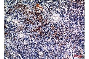Immunohistochemistry (IHC) analysis of paraffin-embedded Human Tonsils, antibody was diluted at 1:100.
