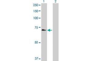 Western Blot analysis of CHEK2 expression in transfected 293T cell line by CHEK2 MaxPab polyclonal antibody. (CHEK2 Antikörper  (AA 1-543))