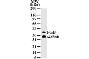 Western Blotting (WB) image for anti-FBJ Murine Osteosarcoma Viral Oncogene Homolog B (FOSB) (AA 2-15) antibody (ABIN207980)