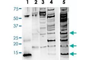 Western Blot analysis of (1) BDNF of rhBDNF R-088-100 (whole serum), (2) BDNF-isoform of rhBDNF R-088-100 (whole serum), (3) SHSY5Y of rhBDNF R-088-100 (whole serum), (4) Human brain of rhBDNF R-088-100 (whole serum), (5) Human brain of R-017-500 (IgG, 10 ug/mL), monomeric BDNF at 14 kDa and proBDNF is detected at the expected molecular weight of 32 kDa for glycosylated proBDNF monomer. (BDNF Antikörper)