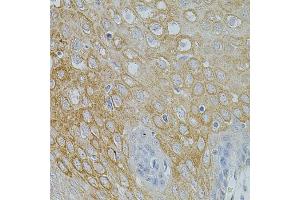 Immunohistochemistry of paraffin-embedded human esophagus using NTF3 antibody (ABIN5971628) at dilution of 1/100 (40x lens).