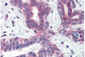 Human Breast (formalin-fixed, paraffin-embedded) stained with XBP1 antibody ABIN337110 at 5 ug/ml followed by biotinylated anti-goat IgG secondary antibody ABIN481715, alkaline phosphatase-streptavidin and chromogen. (XBP1 Antikörper  (AA 358-372))