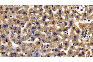 Immunohistochemistry (IHC) image for anti-Insulin-Like Growth Factor 1 (IGF1) (AA 33-102) antibody (ABIN7429310)