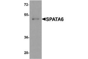 Western blot analysis of SPATA6 in A20 cell lysate with SPATA6 Antibody  at 1 µg/ml.