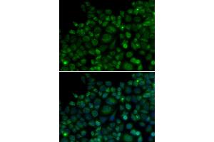 Immunofluorescence analysis of MCF-7 cells using TLR7 antibody (ABIN5970379).