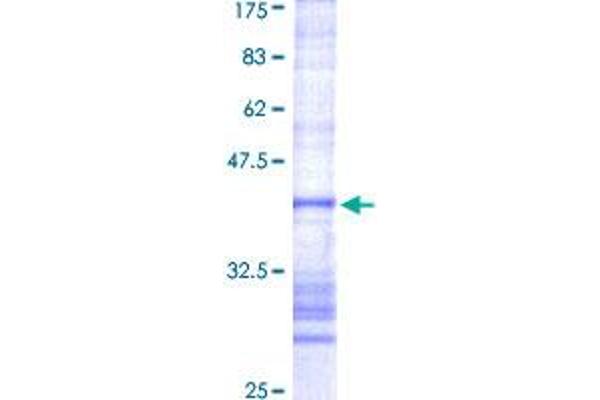 PECI/ECI2 Protein (AA 265-364) (GST tag)