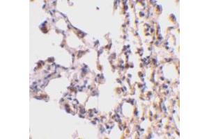 Immunohistochemical staining of mouse lung tissue using AP30147PU-N Bid antibody at 2 μg/ml. (BID Antikörper  (C-Term))