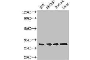 Western Blot Positive WB detected in: U87 whole cell lysate, HEK293 whole cell lysate, Jurkat whole cell lysate, Mouse lung tissue All lanes: LASP1 antibody at 4 μg/mL Secondary Goat polyclonal to rabbit IgG at 1/50000 dilution Predicted band size: 30, 37, 24 kDa Observed band size: 30 kDa (LASP1 Antikörper  (AA 128-252))