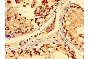 Immunohistochemistry of paraffin-embedded human testis tissue using ABIN7170219 at dilution of 1:100 (SLC28A3 Antikörper  (AA 1-102))