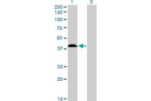 Western Blot analysis of MGC26963 expression in transfected 293T cell line by MGC26963 monoclonal antibody (M08), clone 7D10. (Sphingomyelin Synthase 2 Antikörper  (AA 2-80))