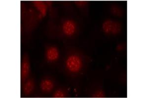 Image no. 3 for anti-Forkhead Box O4 (FOXO4) (pSer197) antibody (ABIN196850) (FOXO4 Antikörper  (pSer197))