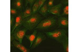 IF analysis of SMC2 and Tubulin beta using anti-SMC2 antibody (ABIN7601453) and anti-Tubulin beta antibody (ABIN7602744).