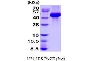 SDS-PAGE (SDS) image for Cathepsin L1 (CTSL1) (AA 18-334) protein (His tag) (ABIN6387773) (Cathepsin L Protein (AA 18-334) (His tag))