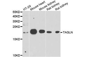 Western blot analysis of extracts of various cell lines, using TAGLN antibody. (Transgelin Antikörper  (AA 1-201))