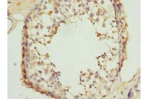 Immunohistochemistry of paraffin-embedded human testis tissue using ABIN7147935 at dilution of 1:100 (CLASP1 Antikörper  (AA 1389-1538))
