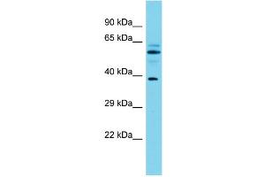 Host: Rabbit Target Name: MACROD1 Sample Type: Fetal Brain lysates Antibody Dilution: 1. (MACROD1 Antikörper  (N-Term))