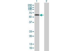 Lane 1: SASS6 transfected lysate ( 55. (SASS6 293T Cell Transient Overexpression Lysate(Denatured))