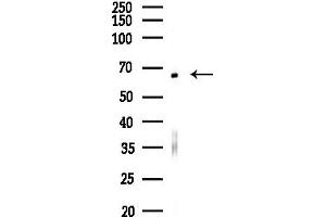 anti-Electron-Transferring-Flavoprotein Dehydrogenase (ETFDH) (C-Term) antibody