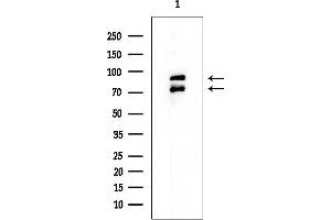 anti-ADAM Metallopeptidase Domain 12 (ADAM12) (N-Term) antibody