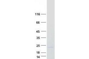 Western Blotting (WB) image for Regulator of G-Protein Signaling 13 (RGS13) (Transcript Variant 2) protein (Myc-DYKDDDDK Tag) (ABIN2730811)