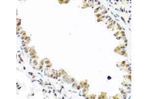 Immunohistochemistry of paraffin-embedded Mouse lung using TET2 Polyclonal Antibody at dilution of 1:100 (40x lens).