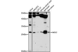 Western blot analysis of extracts of various cell lines, using MSX2 antibody (ABIN3015838, ABIN3015839, ABIN3015840 and ABIN6219185) at 1:1000 dilution. (Msx2/Hox8 Antikörper  (AA 1-267))