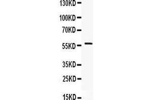 Observed bind size: 58KD (IKZF1 Antikörper  (C-Term))