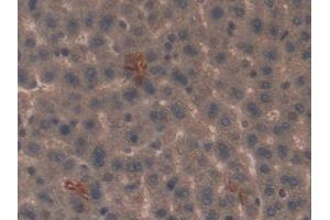 Detection of SP-B in Rat Liver Tissue using Polyclonal Antibody to Surfactant Protein B (SP-B)