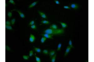 Immunofluorescence staining of Hela cells with ABIN7161047 at 1:166, counter-stained with DAPI. (NRD1 Antikörper  (AA 32-113))
