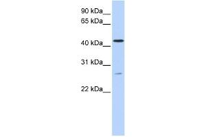 WB Suggested Anti-ACBD5 Antibody Titration:  0. (ACBD5 Antikörper  (C-Term))