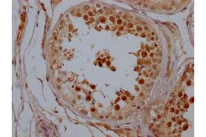 IHC image of ABIN7127809 diluted at 1:100 and staining in paraffin-embedded human testis tissue performed on a Leica BondTM system. (Rekombinanter SIRT1 Antikörper)