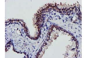 Image no. 5 for anti-V-Akt Murine Thymoma Viral Oncogene Homolog 1 (AKT1) antibody (ABIN1496559) (AKT1 Antikörper)