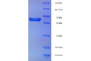SDS-PAGE (SDS) image for Transgelin 2 (TAGLN2) (AA 2-199) protein (His-SUMO Tag) (ABIN5710448)