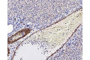 Immunohistochemistry analysis of paraffin-embedded rat liver using LDLR Polyclonal Antibody at dilution of 1:300. (LDLR Antikörper)