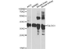 Western blot analysis of extracts of various cell lines, using TALDO1 antibody (ABIN5974092) at 1/1000 dilution. (TALDO1 Antikörper)