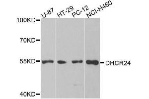Western blot analysis of extracts of various cell lines, using DHCR24 antibody. (Seladin 1 Antikörper  (AA 227-516))